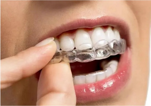 牙齿稀疏矫正费用需要多少?