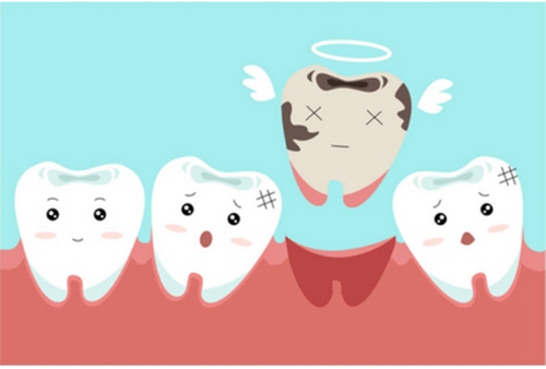 龋齿的治疗方法有哪些?