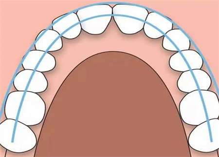 牙齿中线偏移怎么矫正？矫正方法是什么？