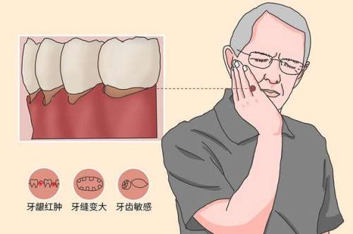 牙龈萎缩怎么恢复正常？